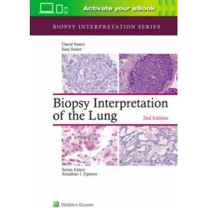 Biopsy Interpretation of the Lung | Saul Suster, Suster, David, MD (ISBN: 9781975136581)