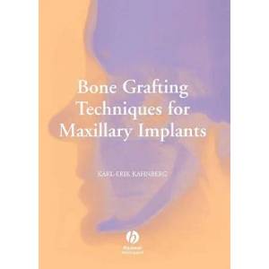Bone Grafting Techniques for Maxillary Implants | Karl-Erik Kahnberg (2005)