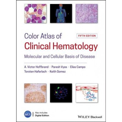 Color Atlas of Clinical Hematology - Molecular and Cellular Basis of Disease Hoffbrand A. VictorPevná vazba