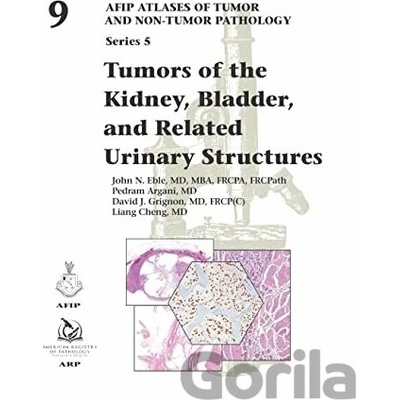 Tumors of the Kidney, Bladder, and Related Urinary Structures Eble John