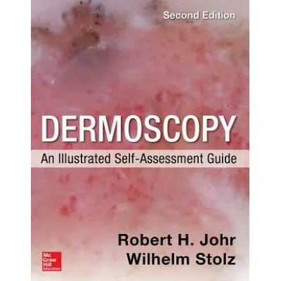 Dermoscopy: An Illustrated Self-Assessment Guide, 2/e | Wilhelm Stolz