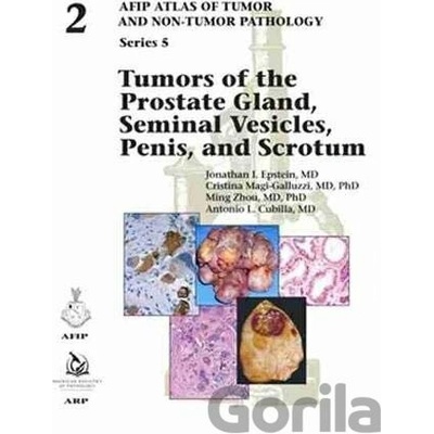 Tumors of the Prostate Gland, Seminal Vesicles, Penis, and Scrotum