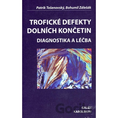 Trofické defekty dolních končetin + CD - Patrik Tošenovský, Bohumil Zálešák