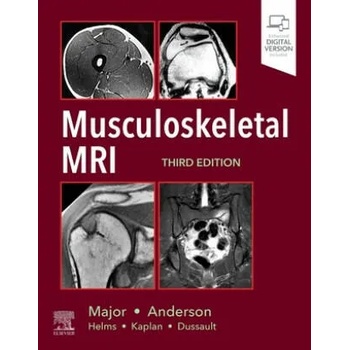 Image 1 of Musculoskeletal MRI