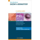 Ekzémy a dermatitidy