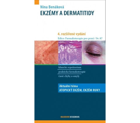 Ekzémy a dermatitidy