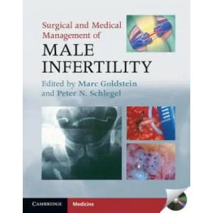 Surgical and Medical Management of Male Infertility | Marc Goldstein (2011)