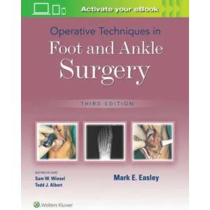 Operative Techniques in Foot and Ankle Surgery | EASLEY, MARK, E (ISBN: 9781975172114)