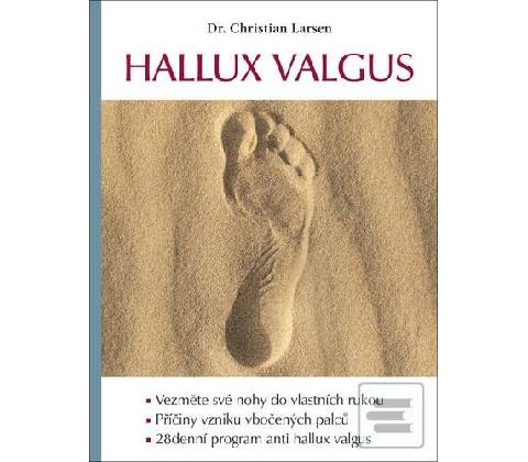 Hallux valgus