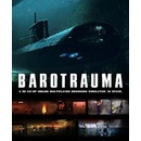 Barotrauma
