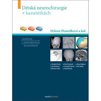 Dětská neurochirurgie v kazuistikách - Helena Homolková a kol.