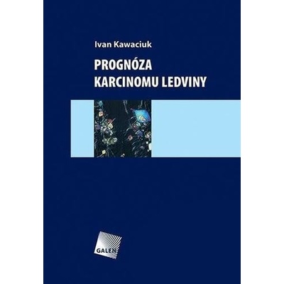 Prognóza karcinomu ledviny - Ivan Kawaciuk