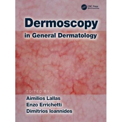 Dermoscopy in General DermatologyPevná vazba