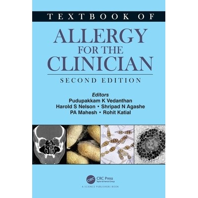 Textbook of Allergy for the Clinician Vedanthan Pudupakkam K.