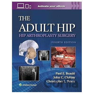 Adult Hip Hip Arthroplasty Surgery Print - Paul Beaule