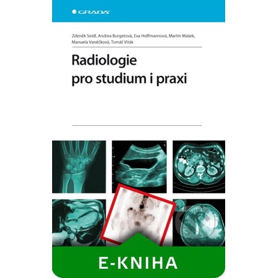 Radiologie pro studium i praxi - Zdeněk Seidl, Andrea Burgetová, Eva Hoffmannová, Martin Mašek, Manuela Vaněčková, Tomáš Viták