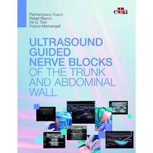 ULTRASOUND GUIDED NERVE BLOCKS OF THE TRUNK AND ABDOMINAL WA