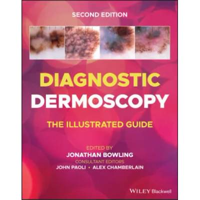 Diagnostic Dermoscopy - The Illustrated Guide, 2e