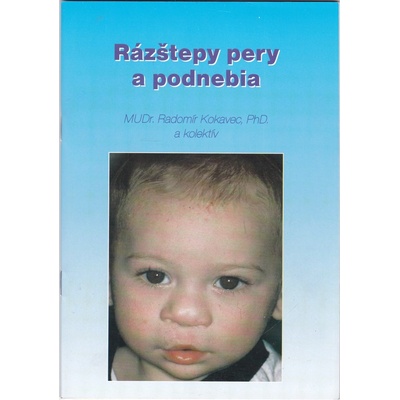 Rázštepy pery a podnebia - Radomír Kokavec