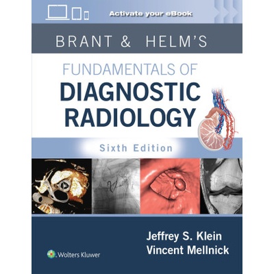 Brant & Helm's Fundamentals of Diagnostic Radiology: Print + eBook with Multimedia | Vincent Mellnick