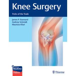 Knee Surgery | Andrew Schmidt, Mauricio Kfuri (ISBN: 9781626235410)