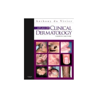 Atlas of Clinical Dermatology | Anthony Du Vivier