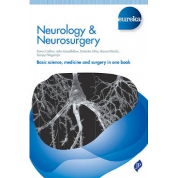 Eureka: Neurology & Neurosurgery | John Goodfellow, Dawn Collins, Dulanka Silva, Ronan Dardis, Sanjoy Nagaraja