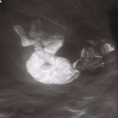 PHOEBE LOU, ALICE - GLOW CD