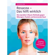 Rosacea - Das hilft wirklich Ring FranziskaPaperback