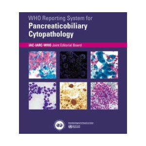 Who Reporting System for Pancreaticobiliary Cytopathology | IAC-IARC-WHO Joint Editorial Board, IAC-IARC-WHO Joint (ISBN: 9789283245186)