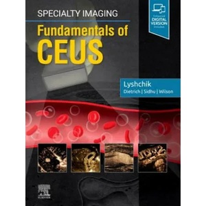 Specialty Imaging: Fundamentals of CEUS | Lyshchik, Andrej, MD, PhD (ISBN: 9780323625647)