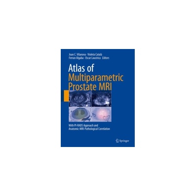 Atlas of Multiparametric Prostate MRI Pevná vazba