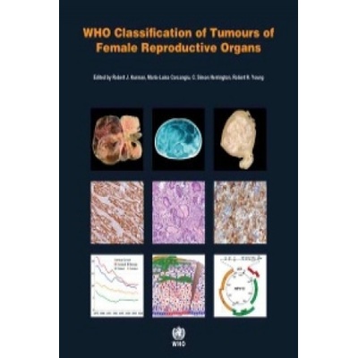 WHO Classification of Tumours of Female Reproductive Organs