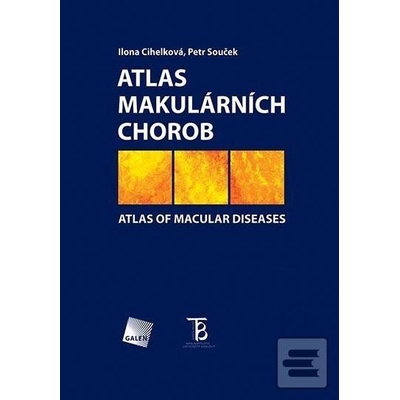 Atlas makulárních chorob - Ilona Cihelková, Petr Souček