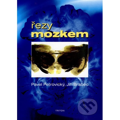 Řezy mozkem - Pavel Petrovický, Jiří Brabec