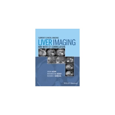 Liver Imaging Braga Larissa
