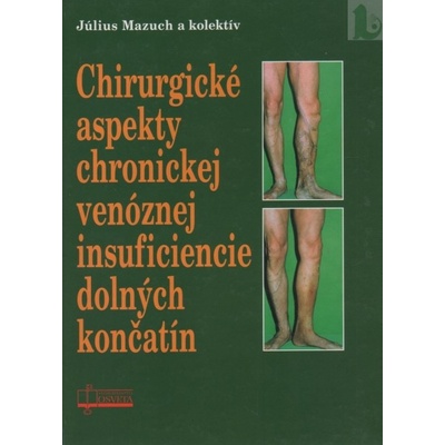 Chirurgické aspekty chronickej venóznej insuficiencie dolných končatín - Július Mazuch a kol.