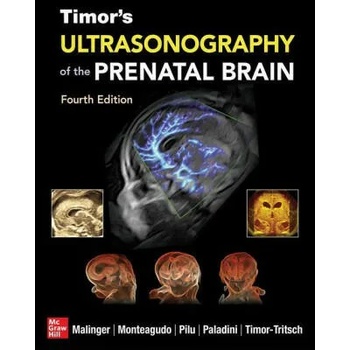 Image 1 of Timor's Ultrasonography of the Prenatal Brain, Fourth Edition | Ana Monteagudo, Gianluigi Pilu, Gustavo Malinger