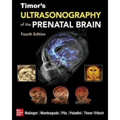 Timor's Ultrasonography of the Prenatal Brain, Fourth Edition | Ana Monteagudo, Gianluigi Pilu, Gustavo Malinger