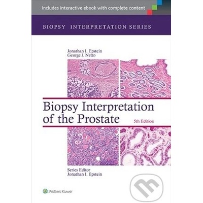 Biopsy Interpretation of the Liver