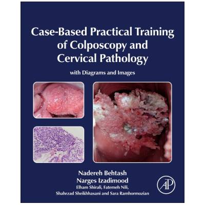 Case-Based Practical Training of Colposcopy and Cervical Pathology | Nadereh Behtash, Narges Izadimood, Elham Shirali, Fatemeh Nili, Shahrzad Sheikhhasani, Sara Ramhormozian