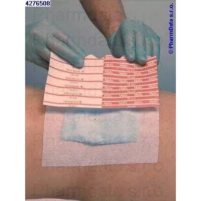 Fixace Mefix samolep.10 m x 2,5 cm 310250
