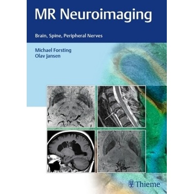 MR Neuroimaging Pevná vazba
