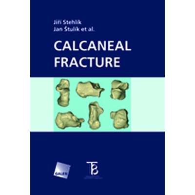 Calcaneal fracture - Jiří Stehlík, Jan Štulík, et al.
