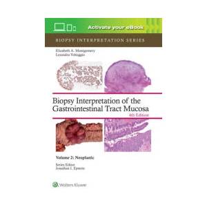 Biopsy Interpretation of the Gastrointestinal Tract Mucosa Volume 2 | Lysandra Voltaggio (ISBN: 9781975213695)