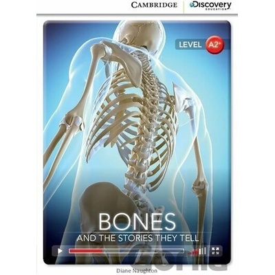 Bones: And the Stories They Tell Low Intermediate Book with Online Access - Diane Naughton