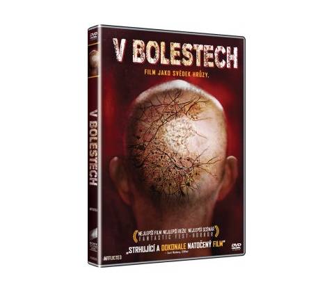 V bolestechQ DVD