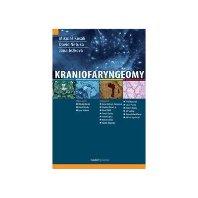 Kraniofaryngeomy