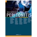 Peritonitis