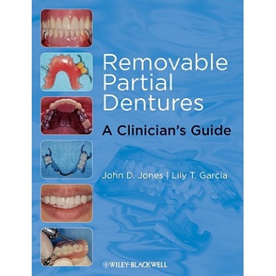 Removable Partial Dentures